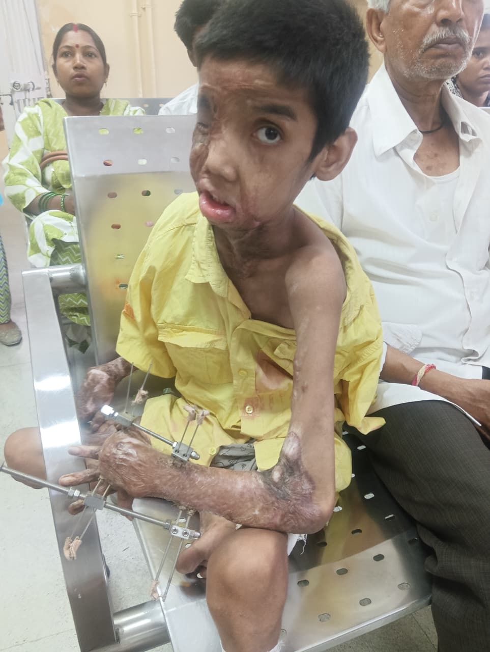 Vishal during treatment at Safdarjung Hospital